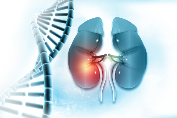 Connecting genetics and real-world evidence to advance kidney disease research