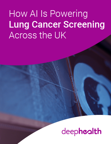 How AI Is Powering Lung Cancer Screening Across the UK