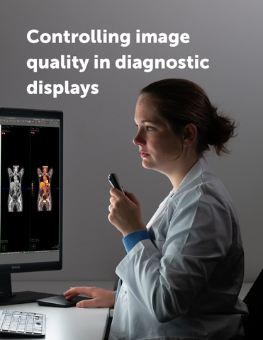 Controlling image quality in diagnostic displays